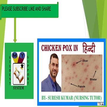 Chickenpox in hindi | PPT