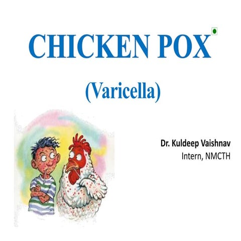 Chicken pox  (varicella)