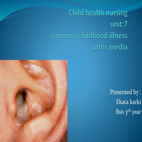 otitis media
