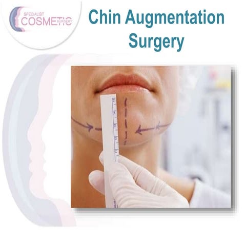 Chin Augmentation Surgery