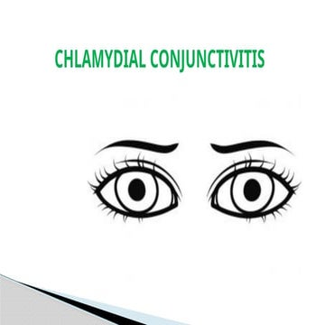 chlamydial conjunctivitis............pptx