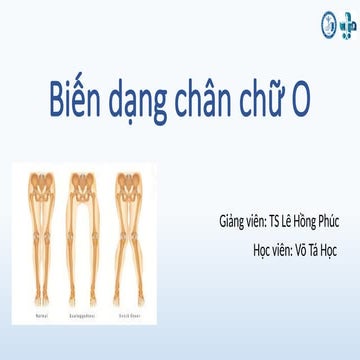Comprehensive Overview of Genu Varum (O-Leg Deformity): Diagnosis ...