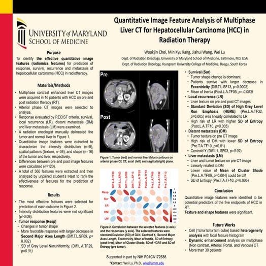 Quantitative Image Feature Analysis of Multiphase Liver CT for Hepatocellular...