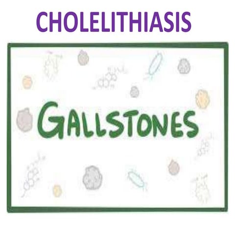 Cholelithiasis