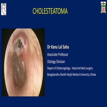 Cholesteatoma