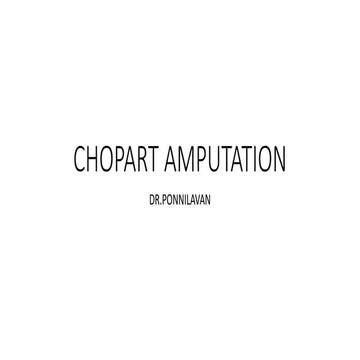 Chopart amputation