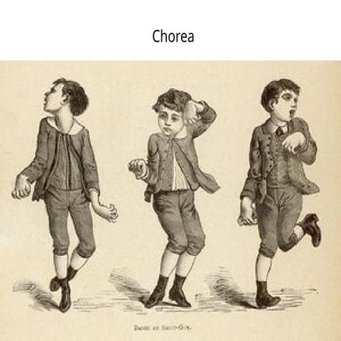Chorea powerpoint presentation for students