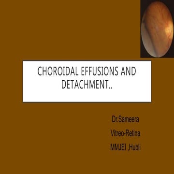 Choroidal detachment  -Nov 2017