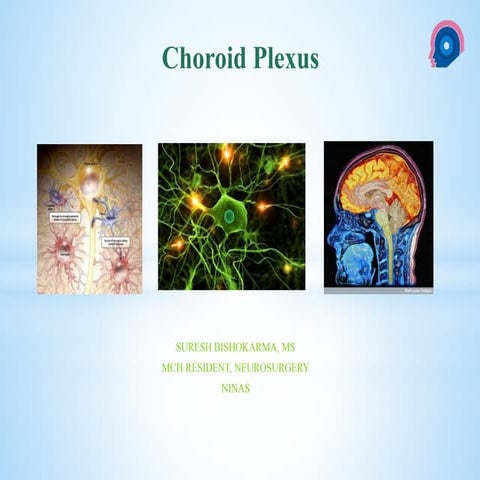 Choroid plexus 