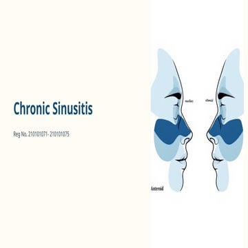 Sinusitis | PPTX