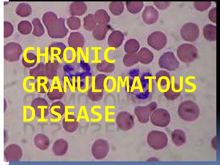 Chronic granulomatous disease