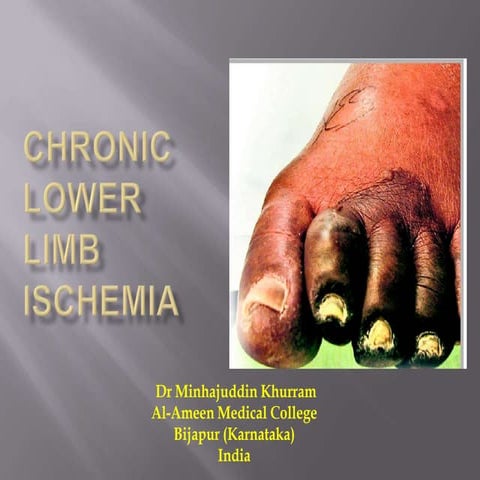 Chronic lower limb ischemia
