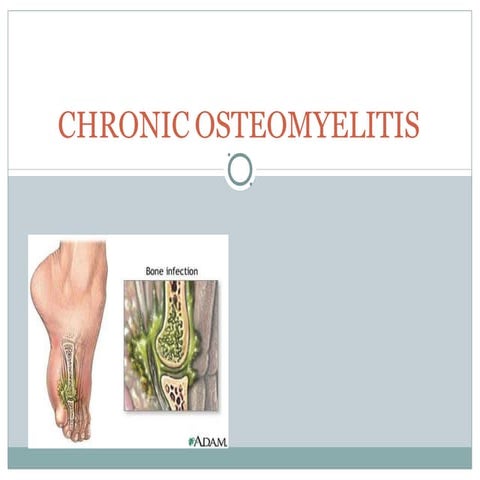 chronicosteomyelitis Powerpt power point