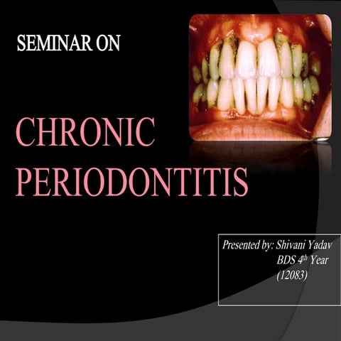 Chronic periodontitis