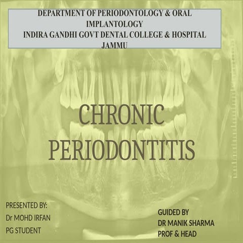 Periodontitis | PPTX
