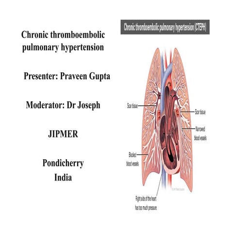 Chronic Thromboembolic Pulmonary artery Hypertension | PPT