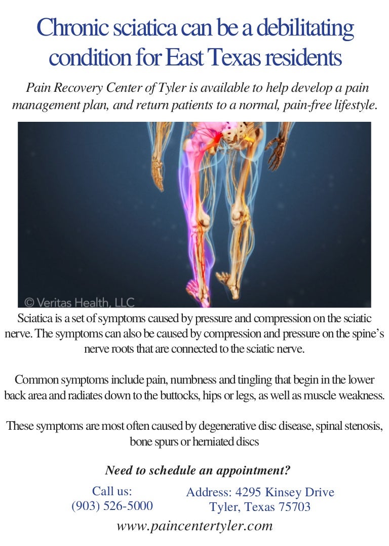 Chronic Sciatica Pain Management Tyler TX