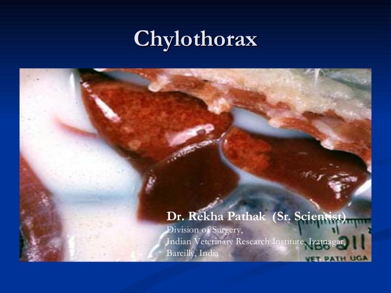 Chylothorax