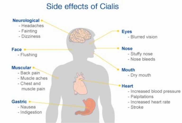 Side Effects Of Cialis