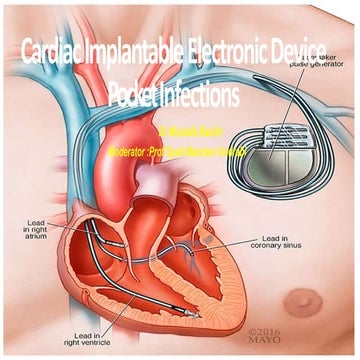 CIED POCKET INFECTION.pptx