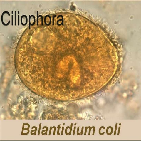 Ciliophora