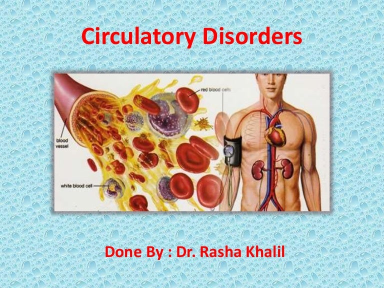 Circulatory disorders