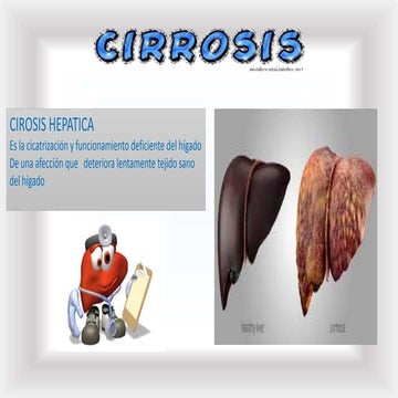 Cirosis hepaticavarices esofagica 2