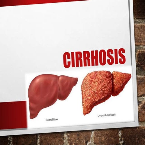 Cirrhosis