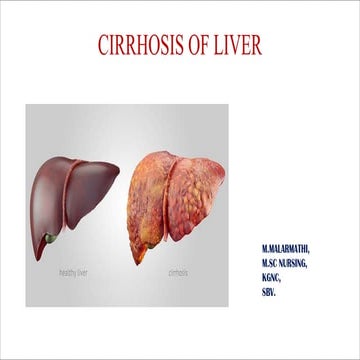 Cirrhosis of liver ppt