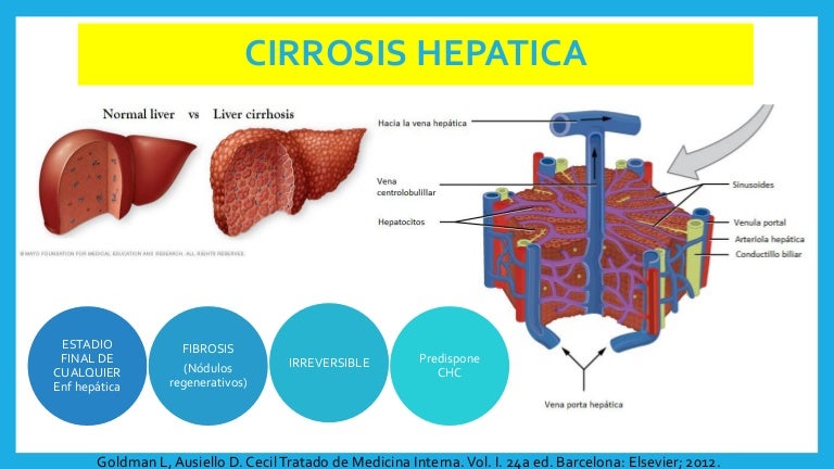diagnóstico de derivación portosistémica de diabetes diagnóstico de derivación portosistémica de diabetes