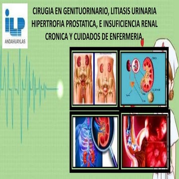 CIRUGIA EN GENITUORINARIO, LITIASIS URINARIA HIPERTROFIA PROSTATICA, E INSUFI...