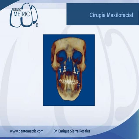 Cirugia maxilofacial