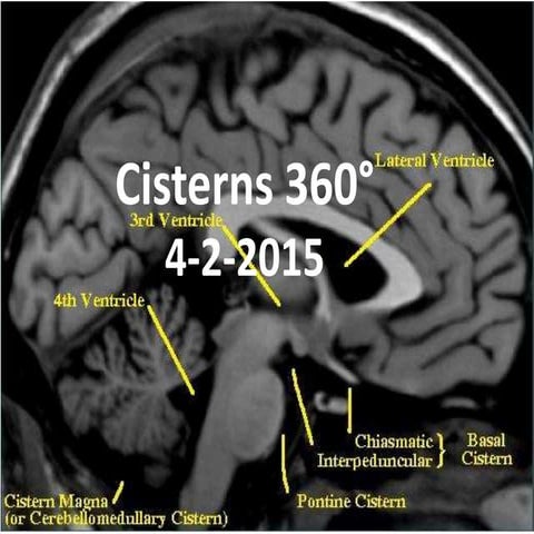 Cisterns 360°