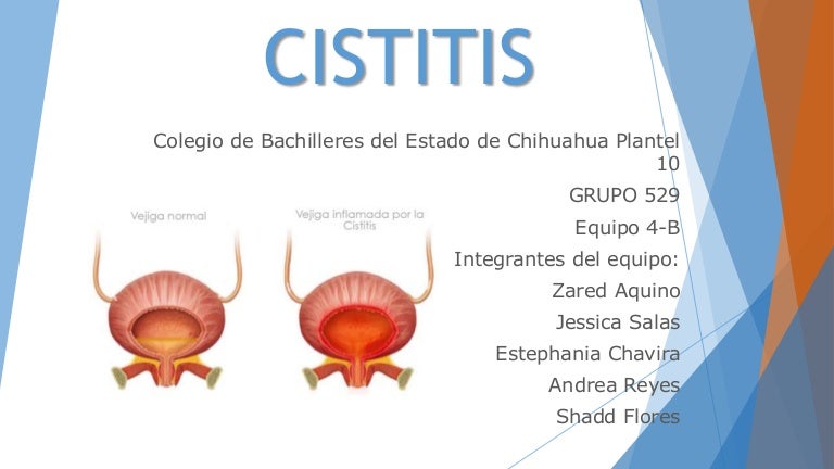 Cistitis