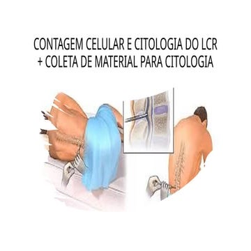 Líquido cefalorraquidiano | PPTX