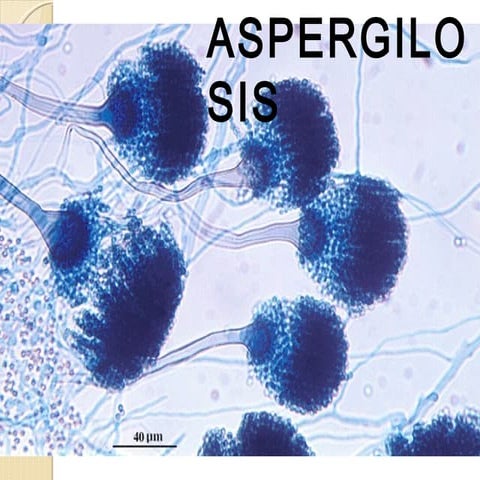 Clase 19 aspergilosis y neumocystosis 2015