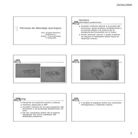Abordaje Hombro humero codo Angela Martines