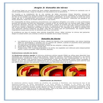 Angiotac: aorta torácica y pulmonares