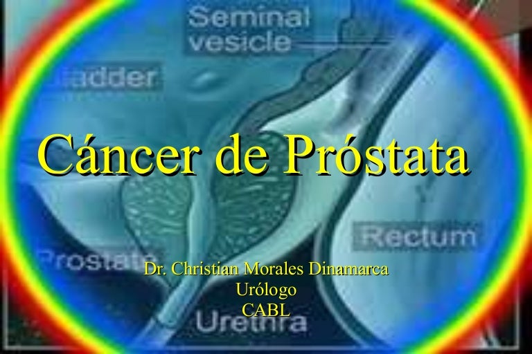 anillos de promesa de estudio de cáncer de próstata