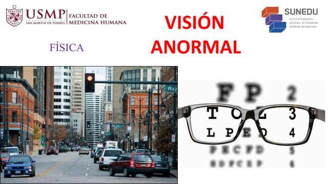 Clase grabada 12 - Visión Anormal (formato PPT).pptx