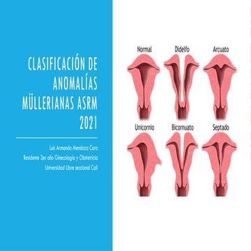 Clasificación de anomalías müllerianas ASRM 2021.pptx