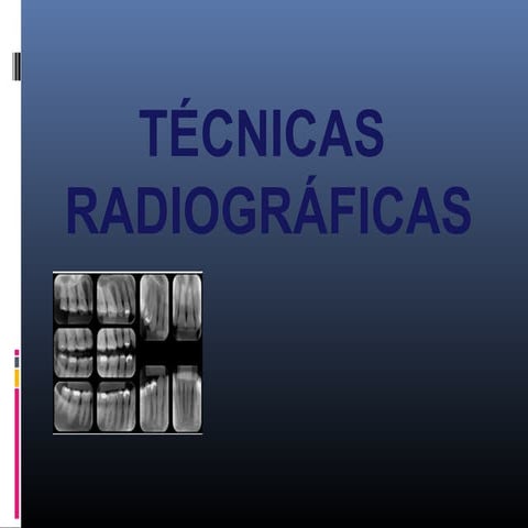 Clasificación radiografias