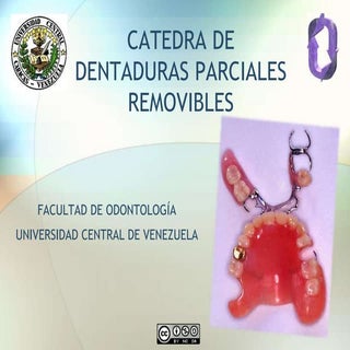 Clasificacion de kennedy