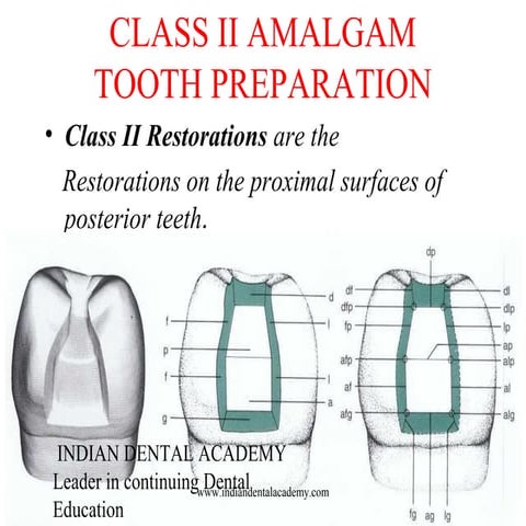 tooth preparation/ dental implant courses