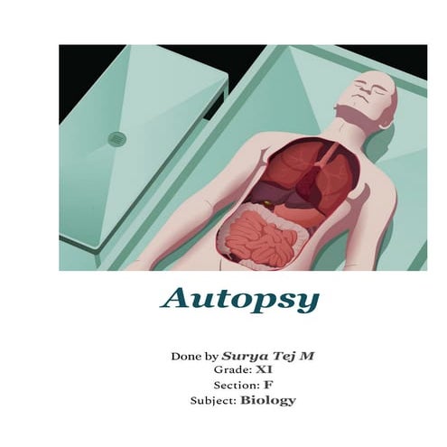 Class 11 and 12 Investigatory project on Autopsy