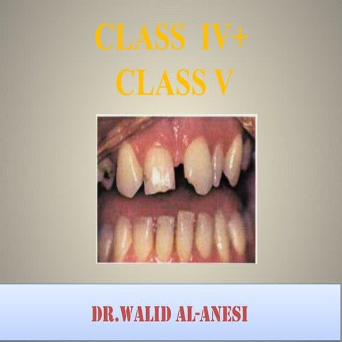Comprehensive Guide to Class IV and Class V Dental Cavity Preparations ...