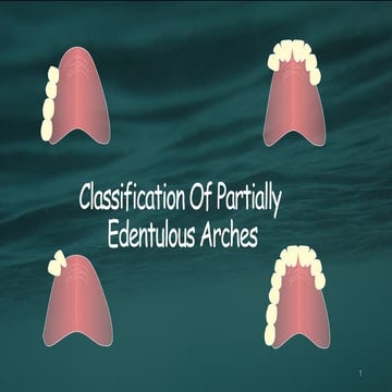 02. kennedy classification | PPTX