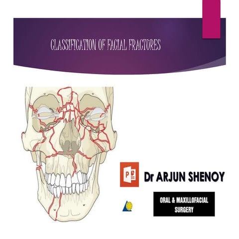 Classification of Mandible, Midface, ZMC and NOE Fractures