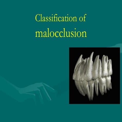 Classification of Malocclusion