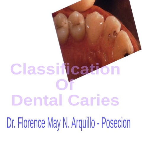 Class v-restoration - Operative | PPTX